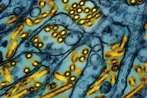 صورة مجهرية توضح فيروس إنفلونزا الطيور H5N1، المرتبط بأول حالة حرجة في الولايات المتحدة، مما يبرز المخاطر الصحية المحتملة.